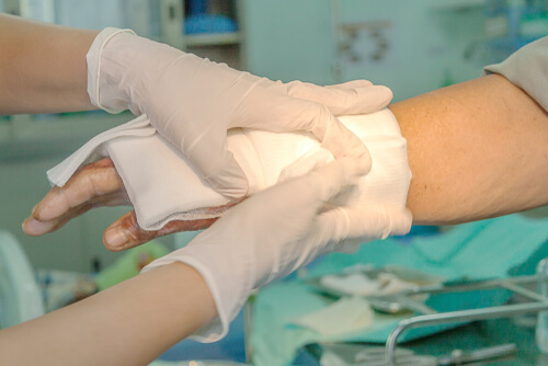 burn injuries