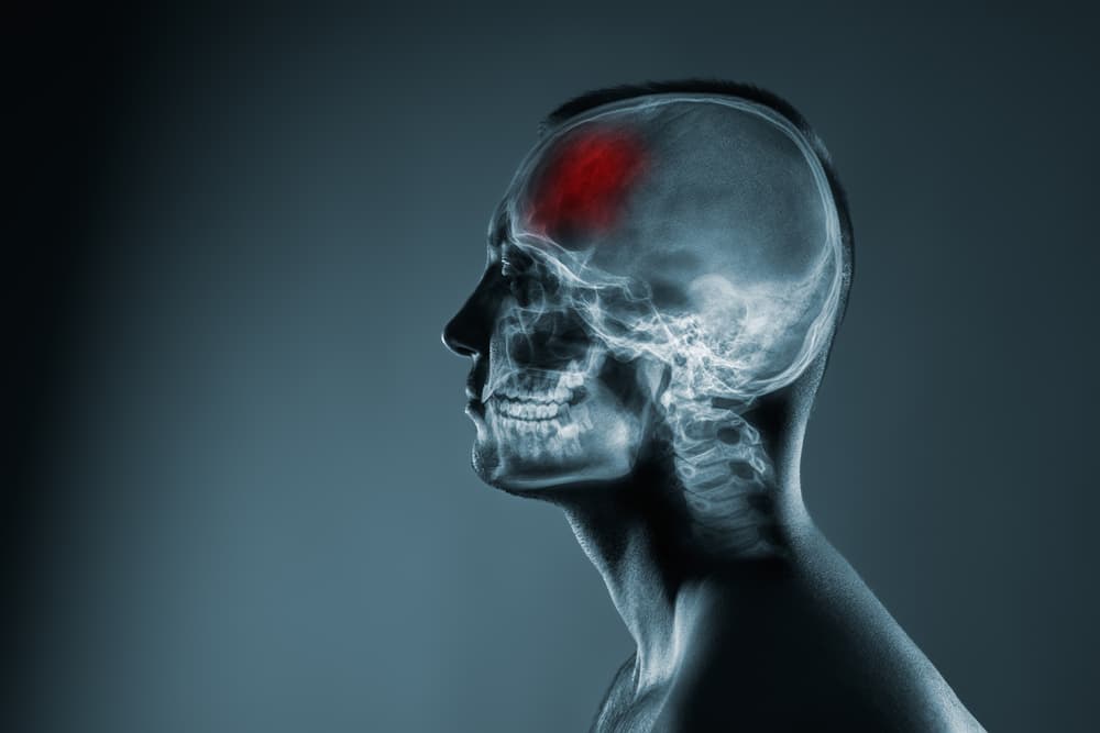 greeneville tbi lawyer